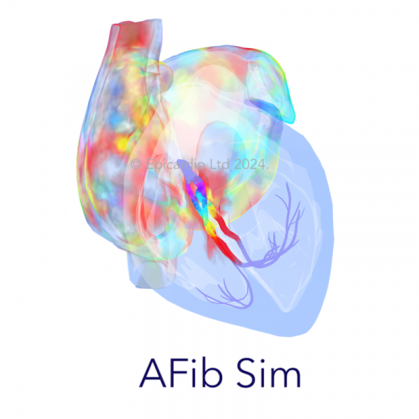 ATRIAL FIBRILLATION monthly