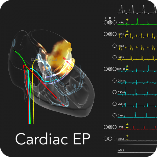 Trainee CARDIAC EP monthly (beta)