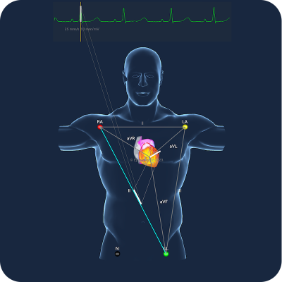 Medical STUDENT ECG monthly