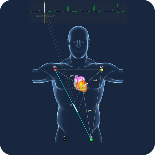 Medical STUDENT ECG monthly